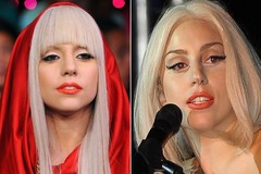 Lady GaGa изменила форму носа и подбородка?