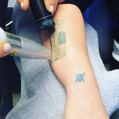 Келли Осборн избавилась от татуировки