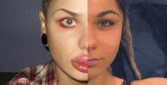 Жительница Петербурга накачала себе самые большие губы в мире Жительница Петербурга накачала себе самые большие губы в мире