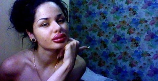 Жительница Петербурга накачала себе самые большие губы в мире Жительница Петербурга накачала себе самые большие губы в мире